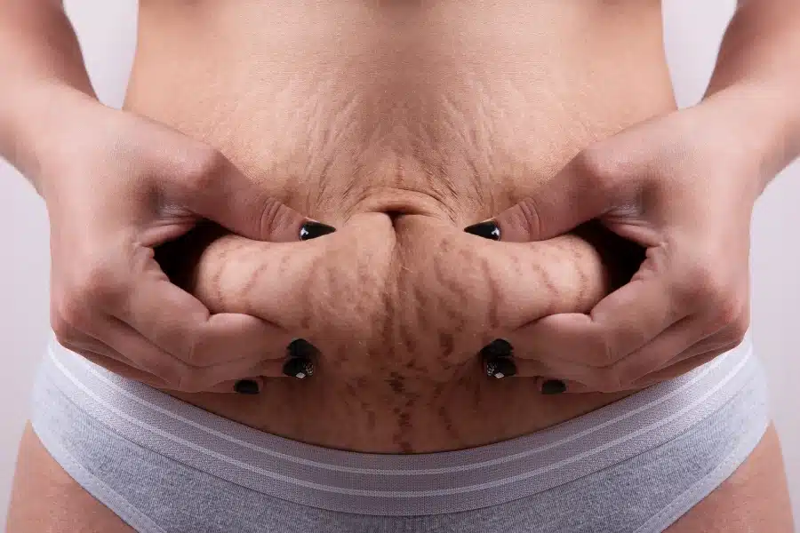 Natural ingredients for losing belly fat