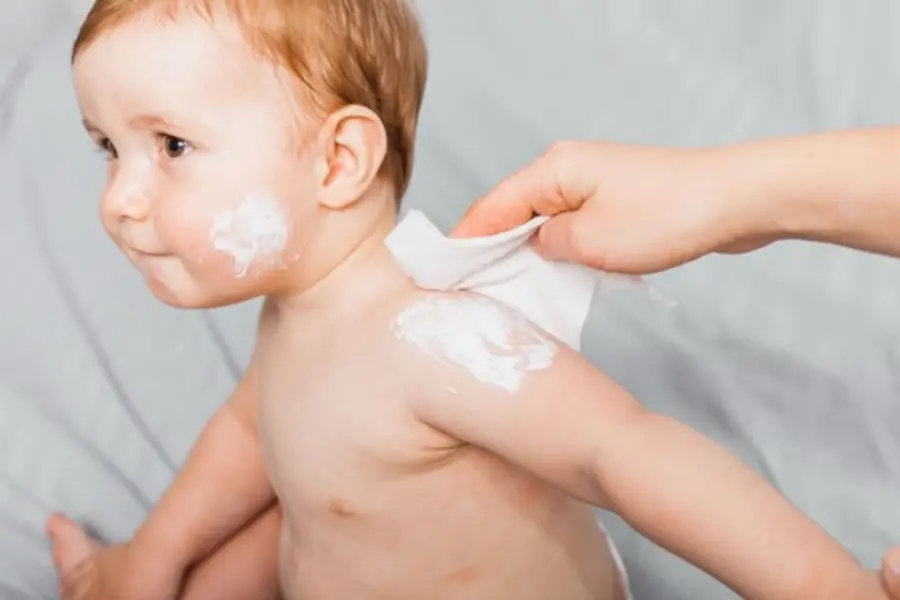 5 Baby Skincare Tips for Parenting