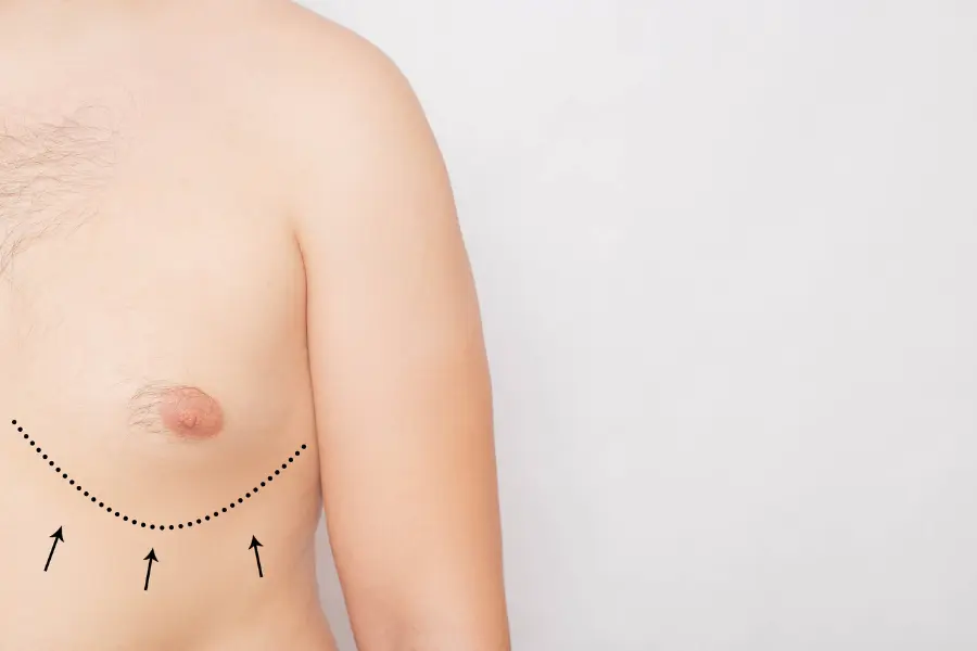 A complete Overview of Nipple Treatment