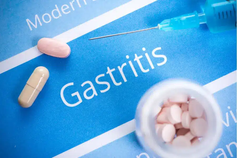 An Overview of Gastritis During Pregnancy