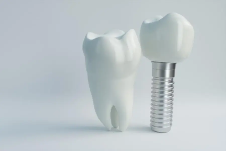 4 Questions to Ask Before Getting Full Mouth Dental Implants