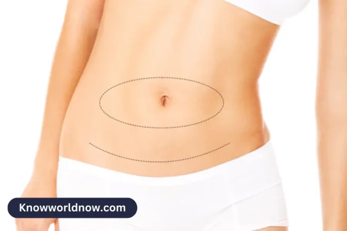 Tummy Tuck Your Path to a Flatter and Contoured Midsection