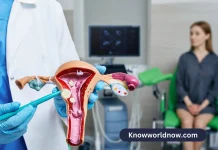 Picture of Fibroid - All You Need to Know