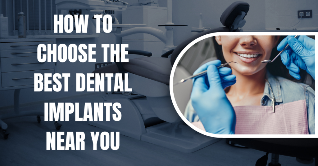 How to Choose the Best Dental Implants Near You
