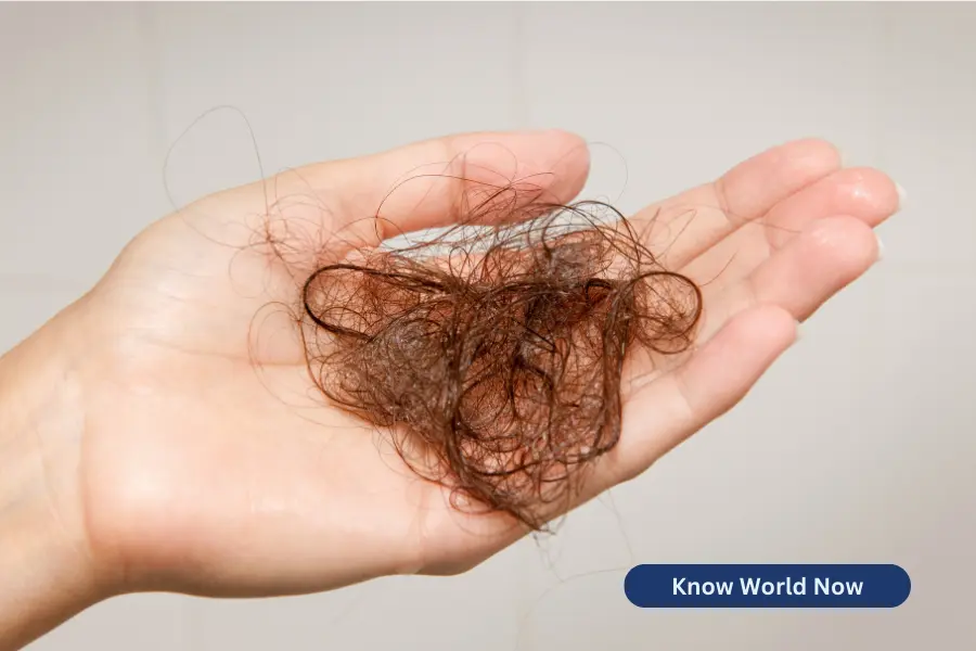 Surprising Causes of Hair Loss