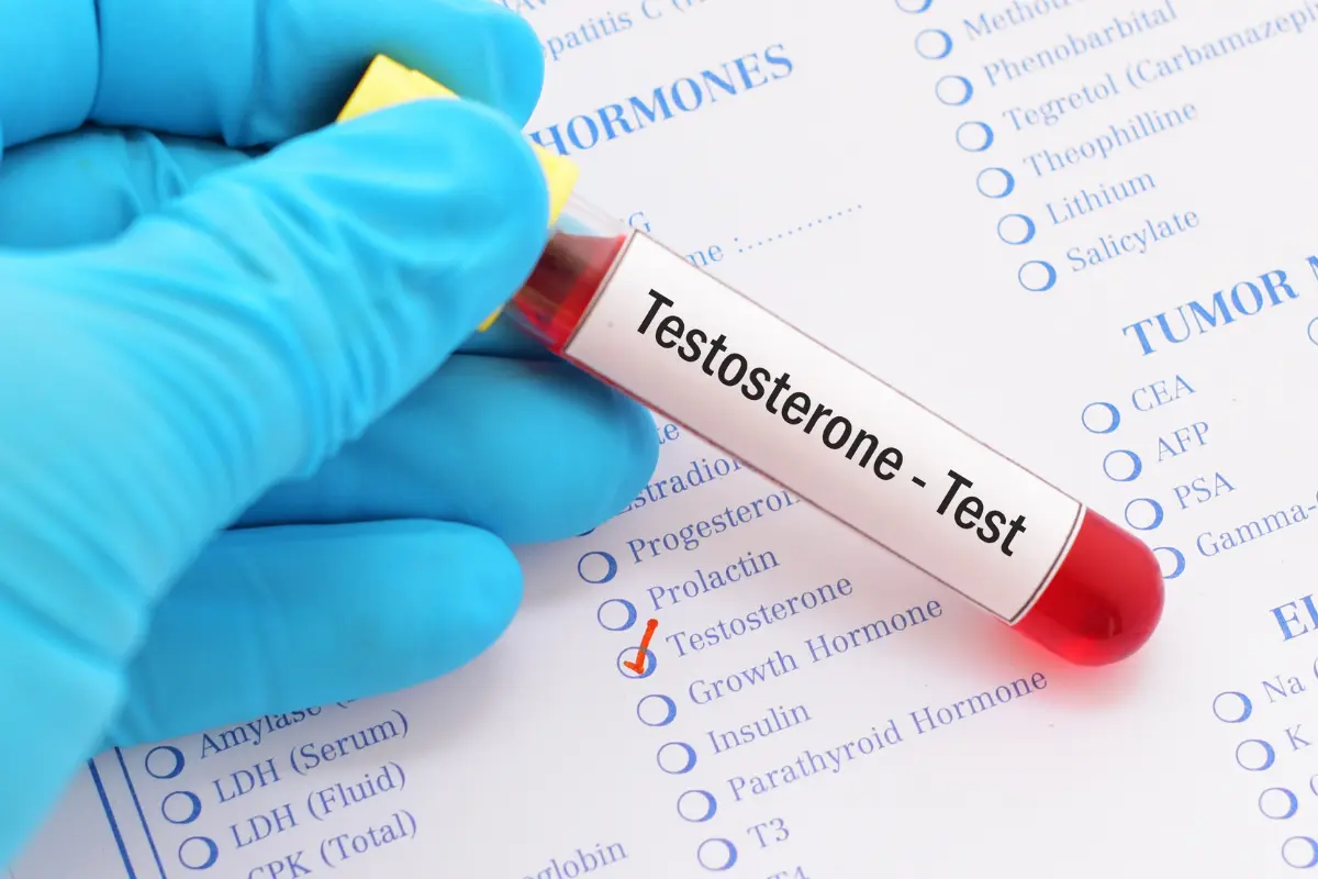 Testosterone Replacement Cedar Park What Makes Testosterone Essential to Men