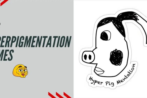 Hyperpigmentation Memes: Funny Dark Spot Struggles & Tips