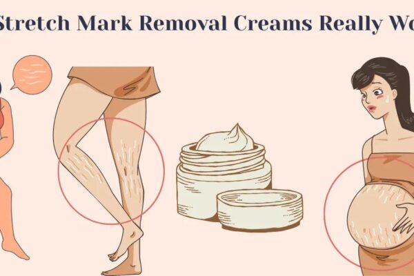 Do Stretch Mark Removal Creams Work? Science-Backed Guide