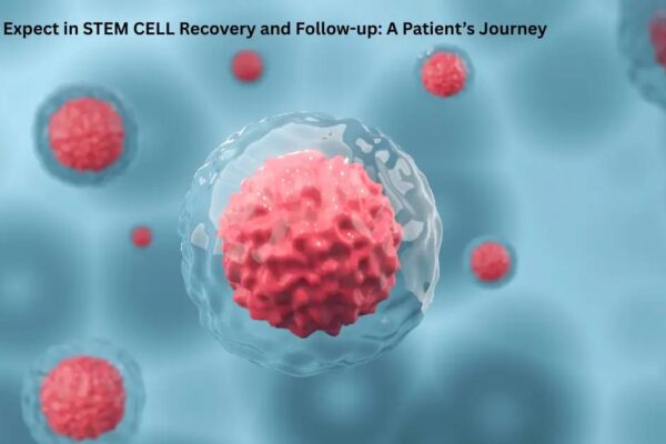 Stem Cell Recovery: What to Expect After Treatment